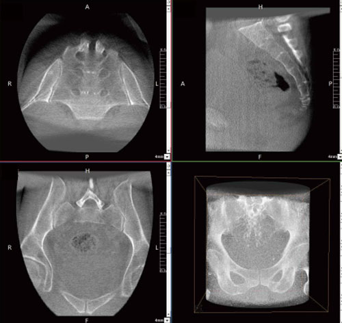 С-дуга PLX C7600